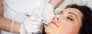 Laser Acne Treatment – Tips About Laser Acne Treatment