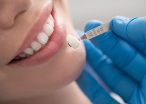 Understanding the Benefits of Cosmetic Bonding