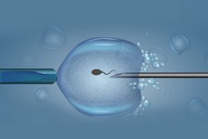 Top Reasons Why ICSI Enhances Fertility Success